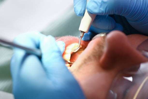 Best Emergency Cosmetic Dentistry (e.g., broken veneers) in Waynesville, NC