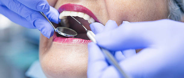 Best Broken or Chipped Tooth Repair in Waynesville, NC